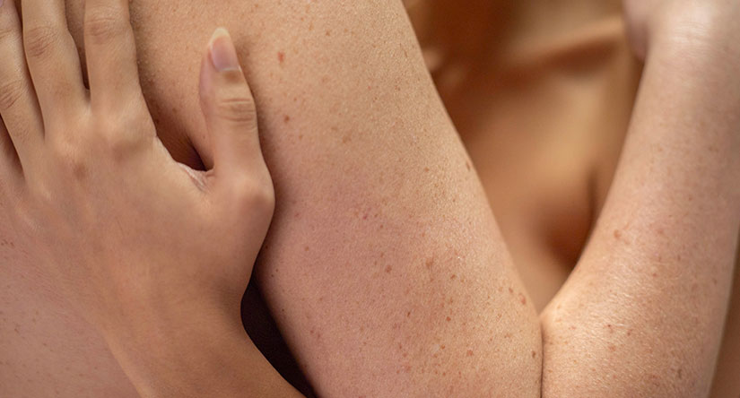 Gros plan sur deux personnes à la peau claire et constellée de taches de rousseur qui s'enlacent, mettant en valeur le contact de leur peau.
