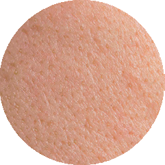 Un cercle montrant en gros plan une peau avec des pores légèrement dilatés et un aspect brillant.